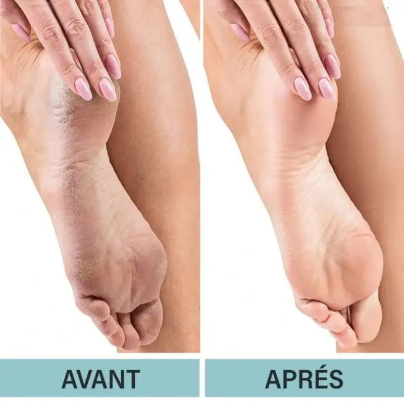 Élégance Pieds – Lisseur Talons Pro 𝐩𝐨𝐮𝐫 𝐡𝐨𝐦𝐦𝐞 𝐞𝐭 𝐟𝐞𝐦𝐦𝐞
