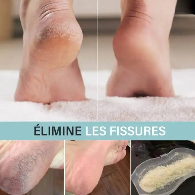 Élégance Pieds – Lisseur Talons Pro 𝐩𝐨𝐮𝐫 𝐡𝐨𝐦𝐦𝐞 𝐞𝐭 𝐟𝐞𝐦𝐦𝐞